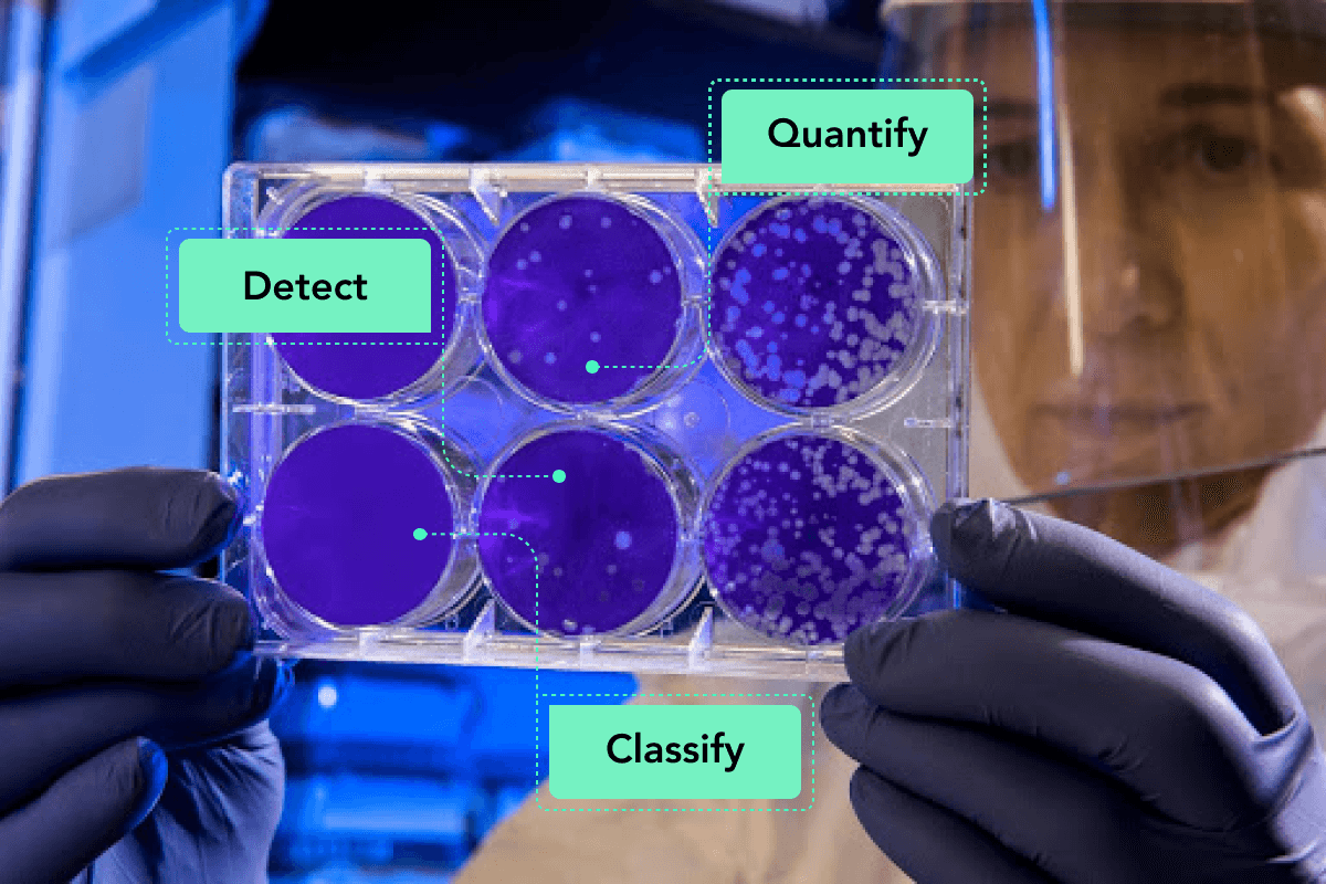 Medical Image Analysis: Bacteria Counting