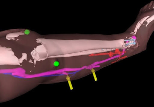 ARVR in Healthcare Training, Telemedicine